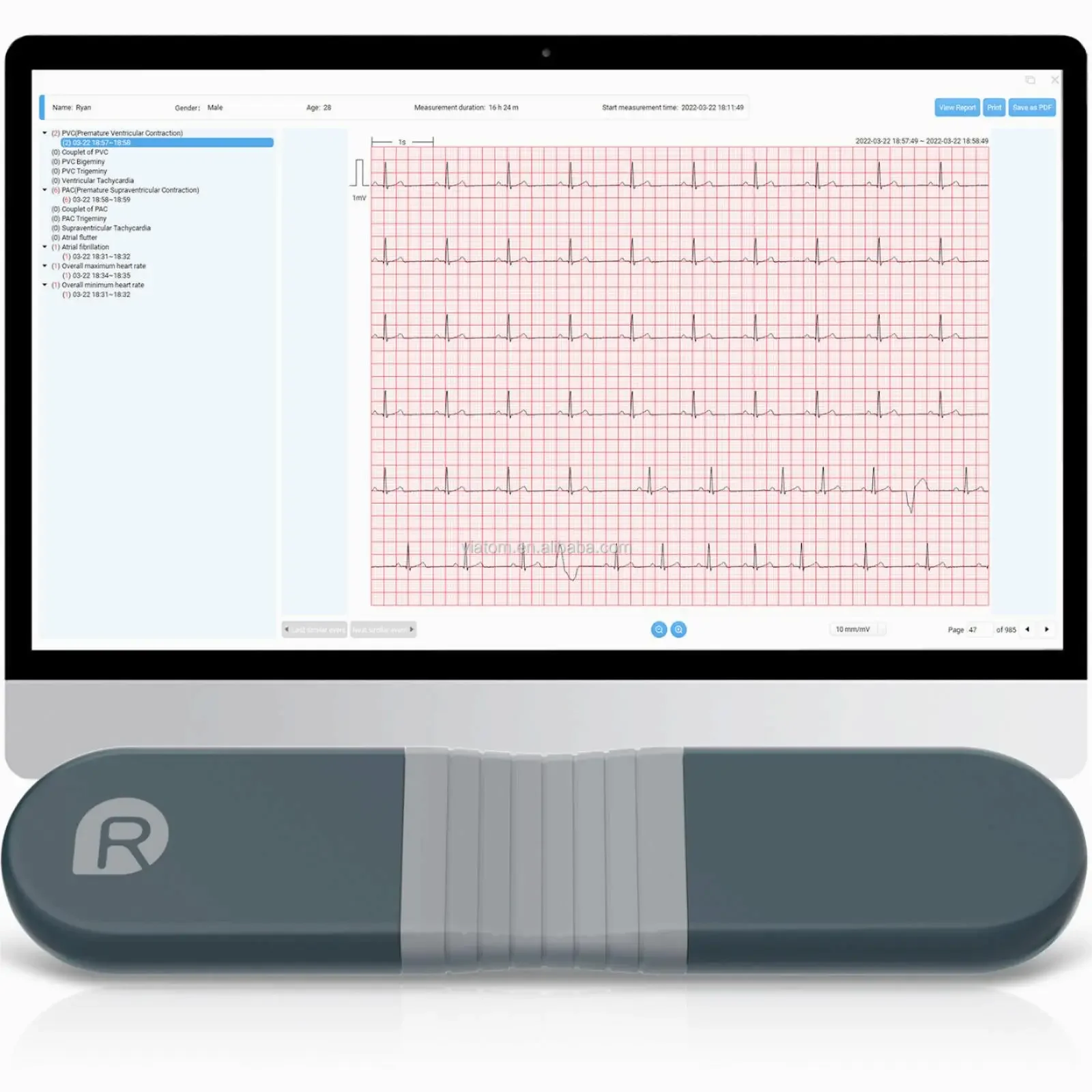Wireless Bluetooth Dynamic Rec - Ecg Patch Monitor avis et prix